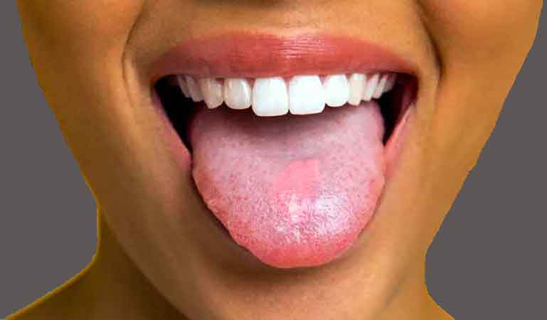 human tongues